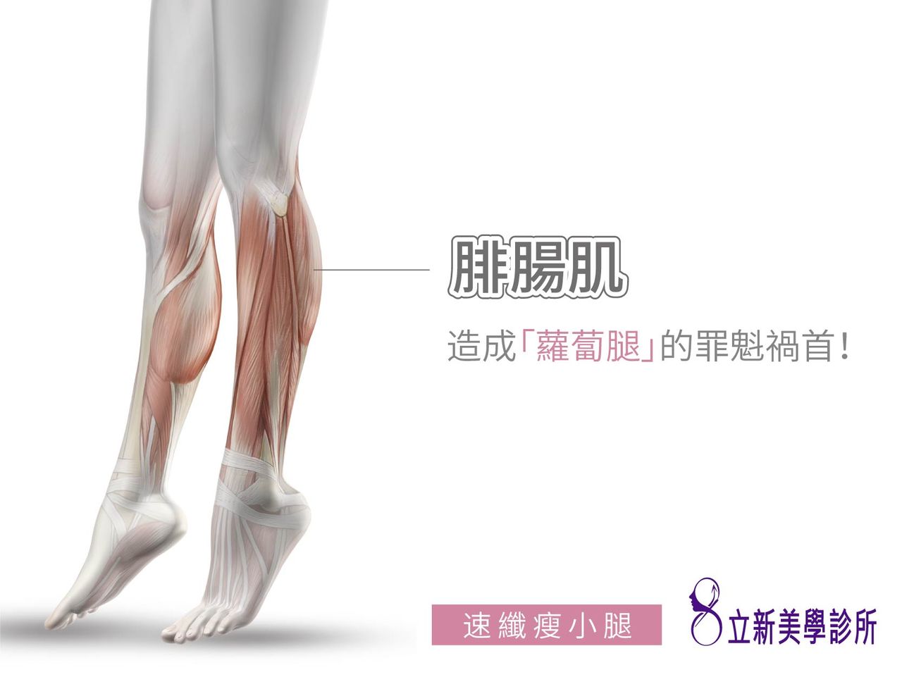 腓腸肌，造成蘿蔔腿的罪魁禍首