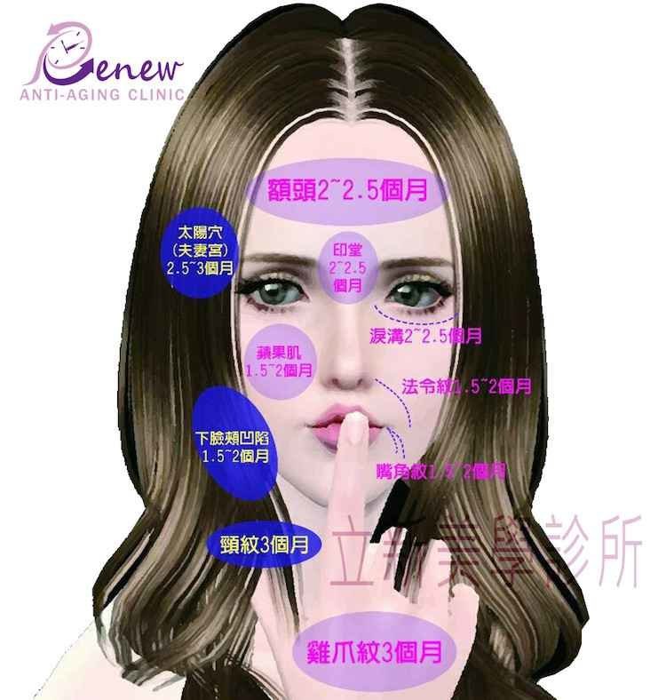 舒顏萃聚左旋乳酸(俗稱童妍針)術後生成時間表,真美學診所,張光正醫師
