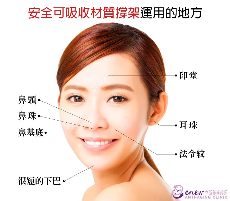 她是我女友，不是我媽！化解誤會快用【自體法令紋+3999安全可吸收材質撐架】，反轉視覺年齡差距