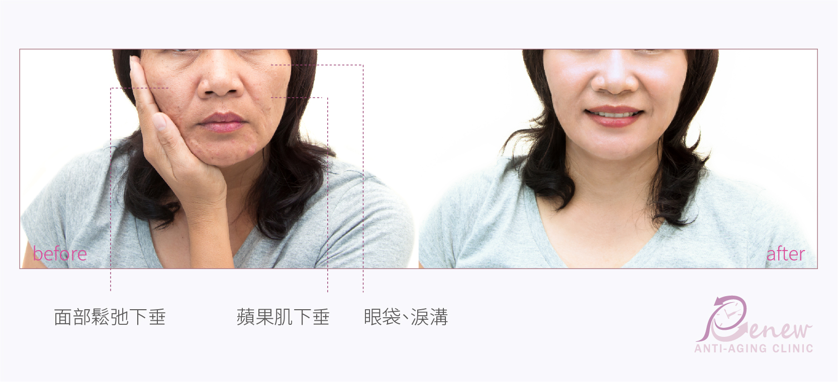 (對比圖)