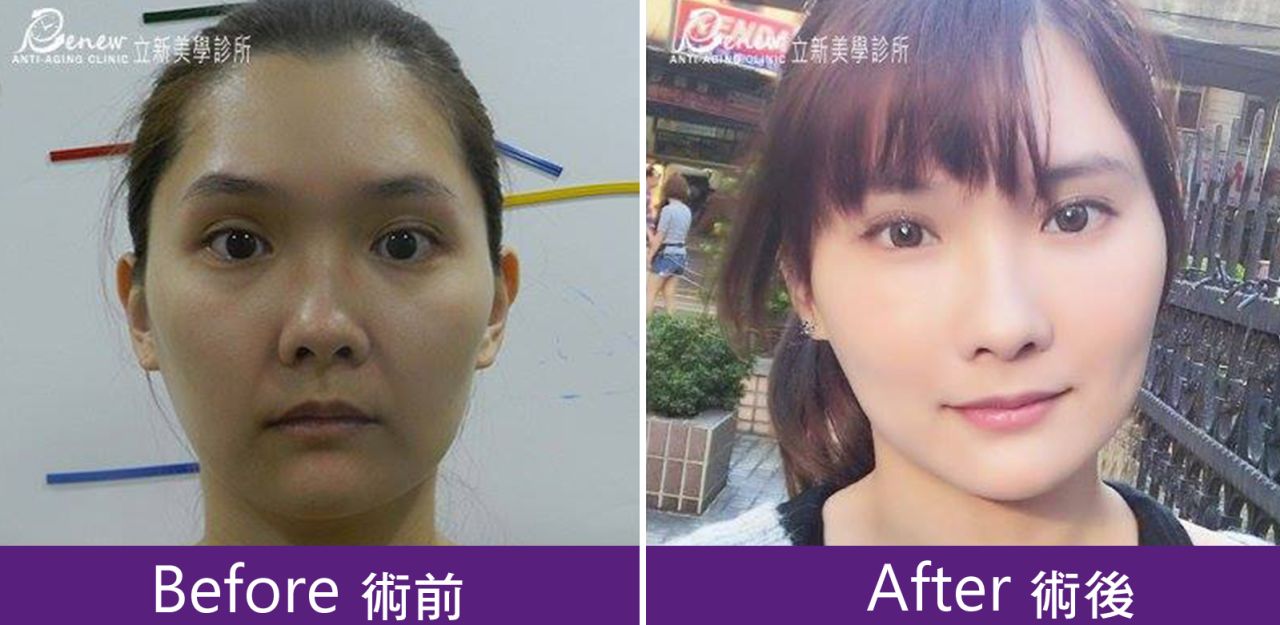 (對比圖)