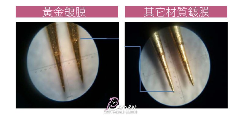 【美魔黃金電波】一機搞定！皺紋、凹洞疤瑕疵膚質、松垂肌 通通OUT！,黃金鍍膜,其他材質