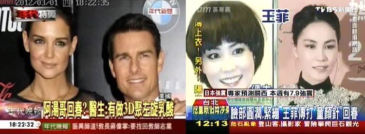 舒顏萃聚左旋乳酸(俗稱童妍針),您知道巨星是如何凍齡嗎？！