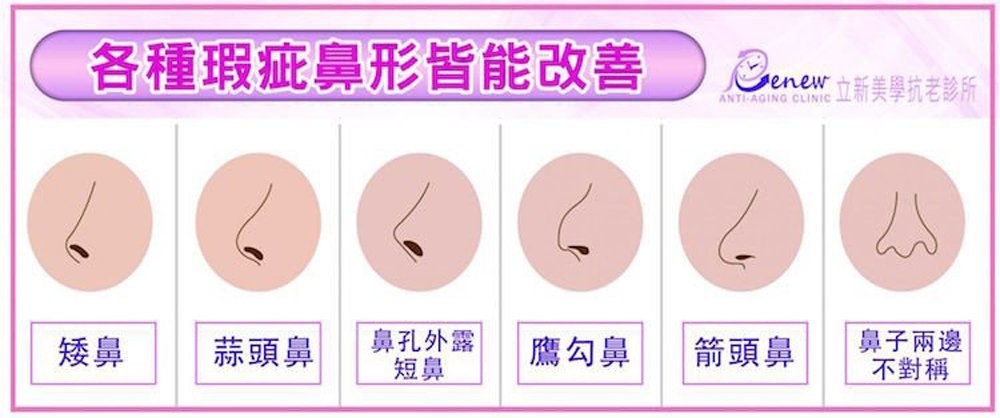 各種瑕疵鼻形皆能改善