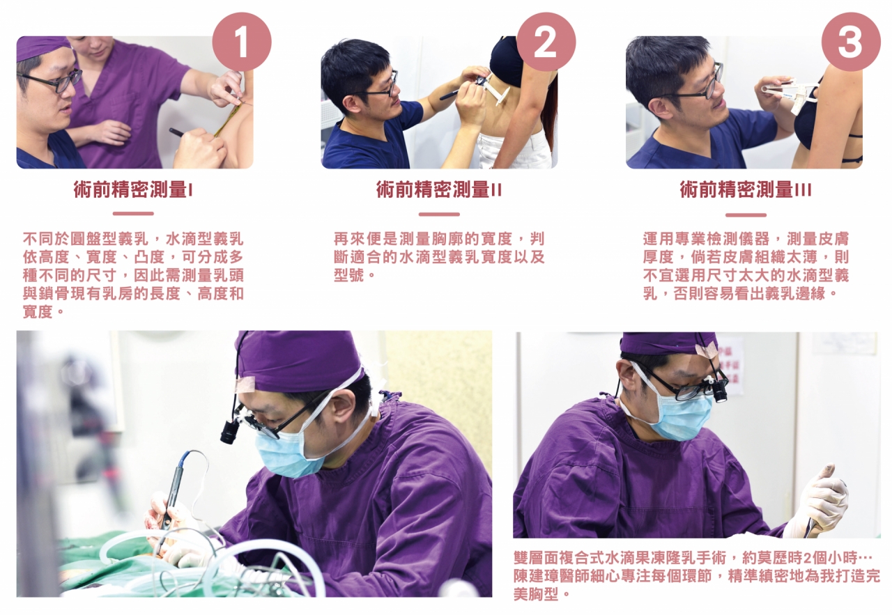 術前精密測量-水滴型義乳可分成多種不同尺寸,再來是測量胸廓的寬度,判斷適合的型號,雙層面複合式水滴果凍隆乳手術在醫師細心專注每個細節,精準縝密的為您打造完美胸型!