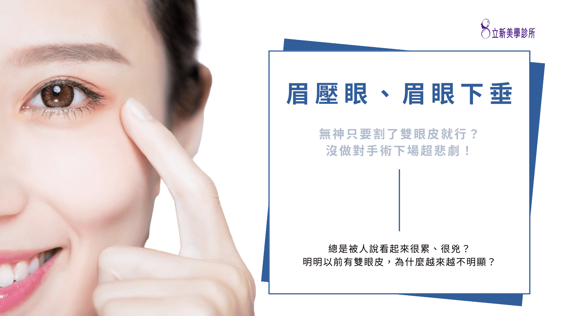眉壓眼、眉眼下垂 無神只要割了雙眼皮就行了?沒做對手術下場超悲劇!