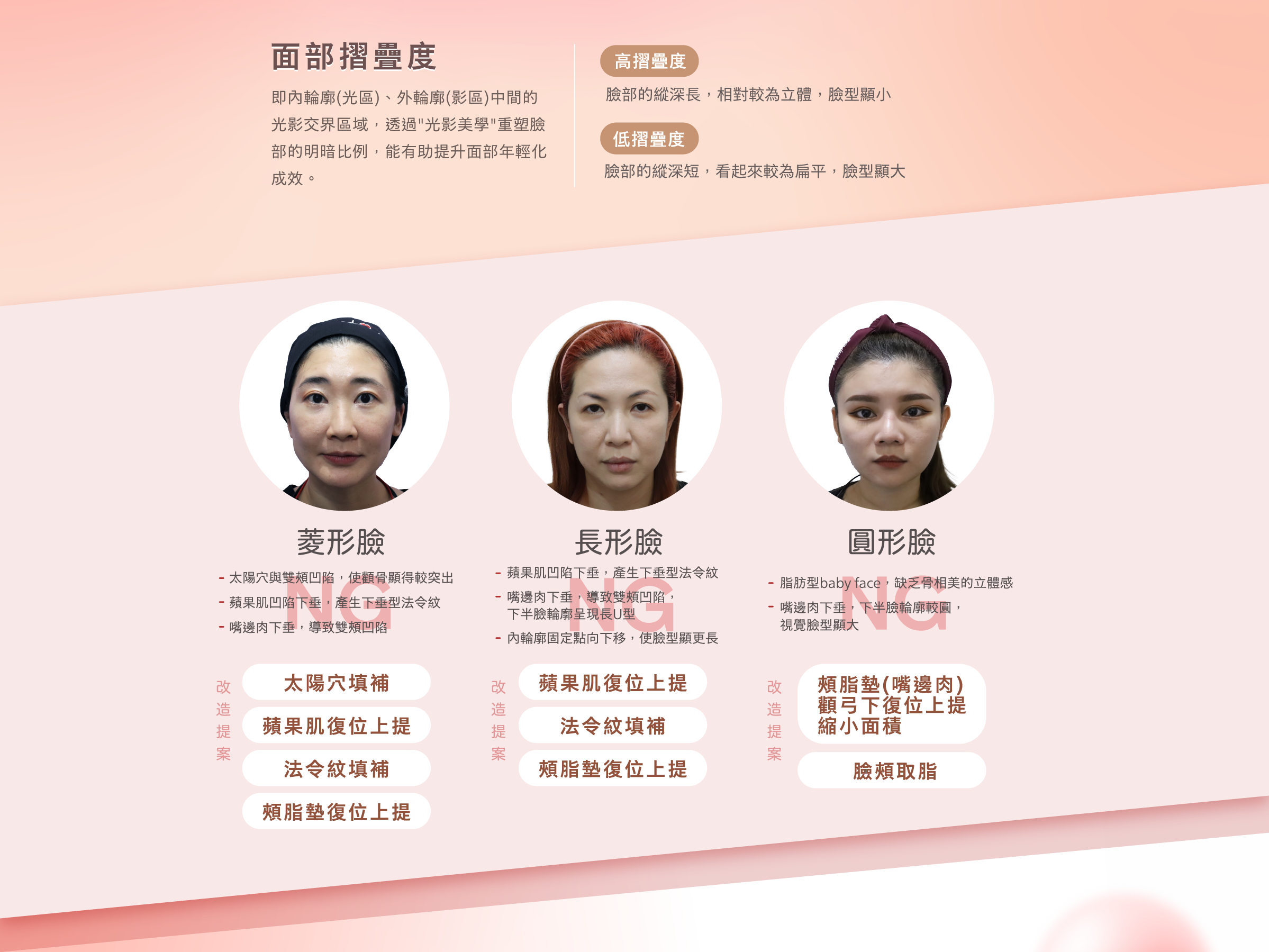 3個案例